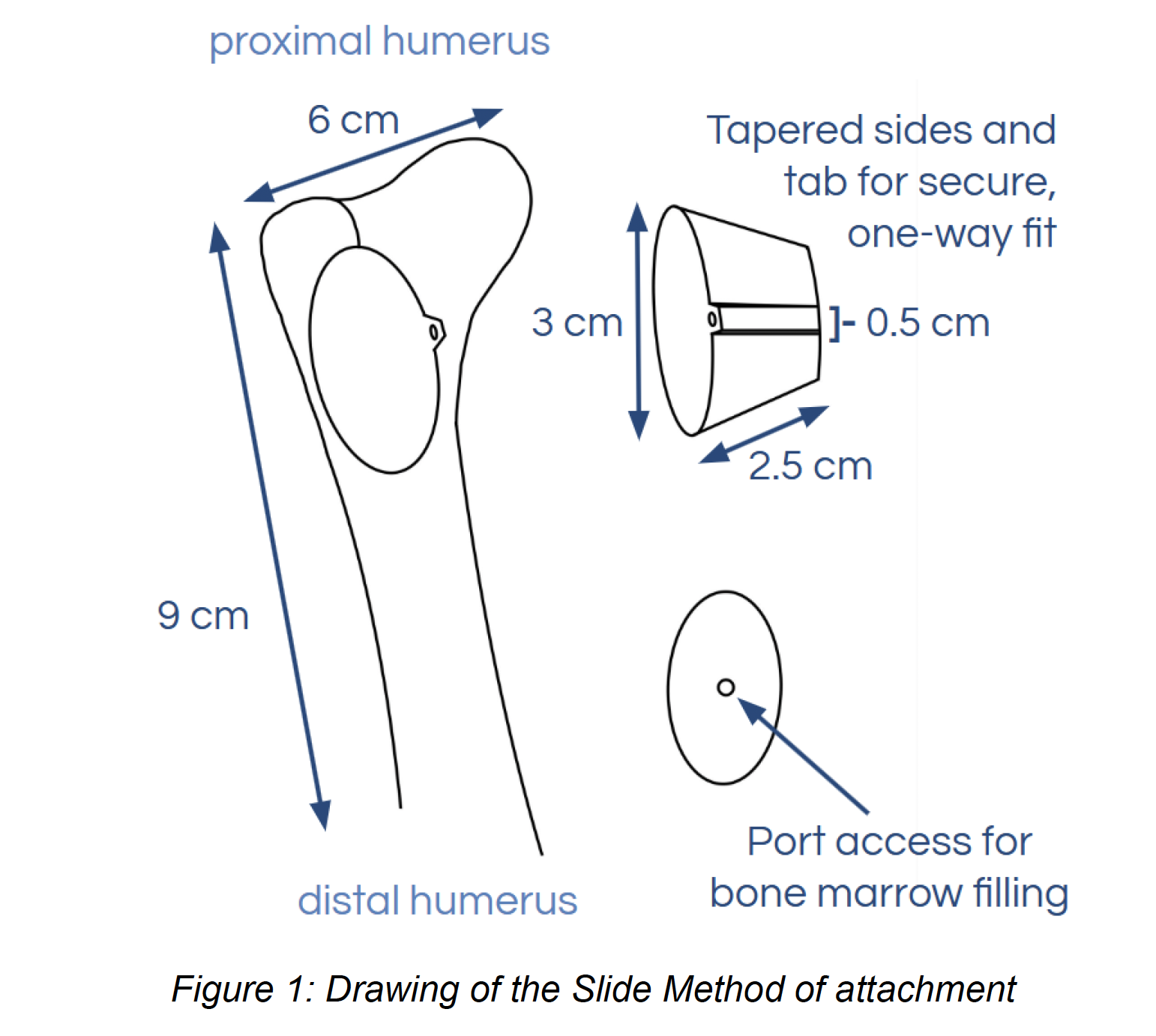 Specs for the humerus modular components.